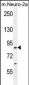 CCDC123 Antibody (C-term)